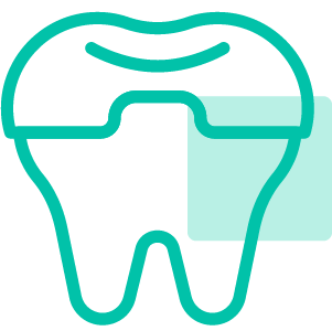 Tooth-Colored Fillings
